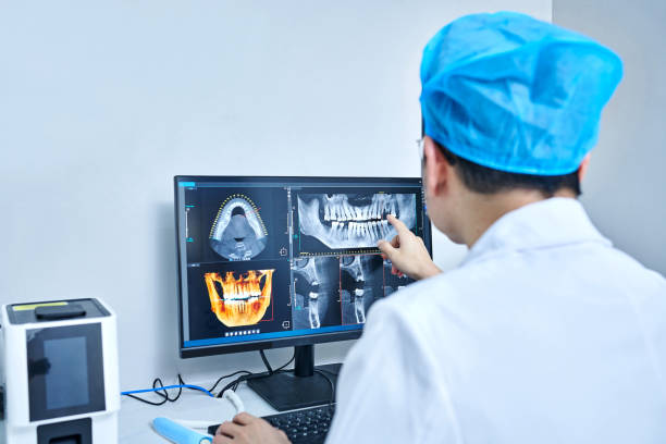 Best Emergency Dental Care for Broken or Chipped Teeth in Milton, WI