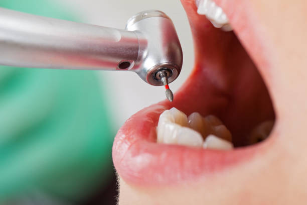 Best Weekend Emergency Dentist in Milton, WI